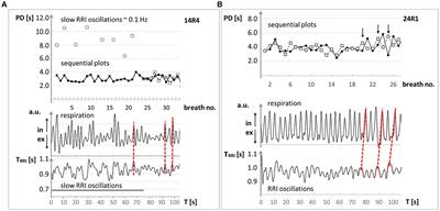 Scan-associated anxiety (scanxiety): the enigma of emotional breathing oscillations at 0.32 Hz (19 bpm)